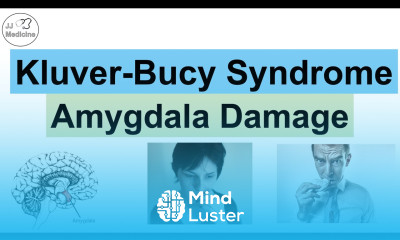 Kluver Bucy Syndrome Causes Pathophysiology Signs Symptoms Diagnosis Treatment