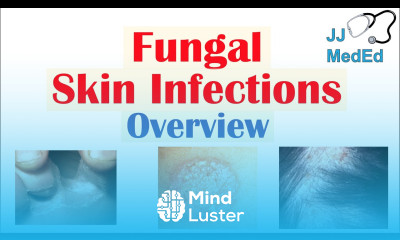 Overview of Fungal Skin Infections Tinea Infections