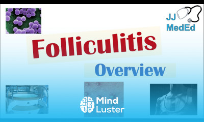 Folliculitis Causes Bacterial Fungal Viral Risk Factors Symptoms Diagnosis Treatment