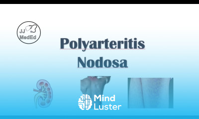 Polyarteritis Nodosa PAN Signs Symptoms Diagnosis Treatment