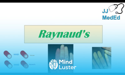 Introduction to Raynaud s Phenomenon Syndrome Pathophysiology Triggers Symptoms Treatment