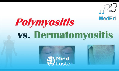Idiopathic Inflammatory Myopathies Polymyositis vs Dermatomyositis