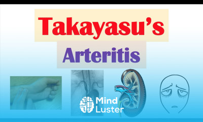Takayasu s Arteritis Pulseless Disease Large Vessel Vasculitis Symptoms Diagnosis Treatment