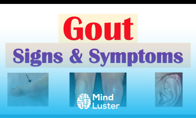 Gout Signs and Symptoms Why They Occur