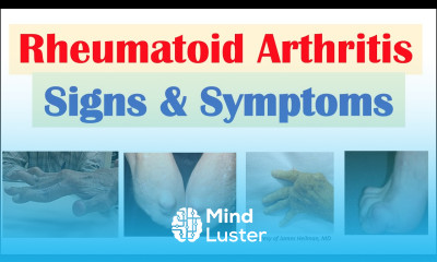 Rheumatoid Arthritis RA Signs Symptoms Associated Complications