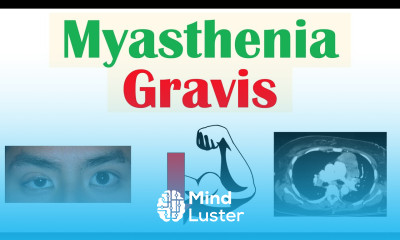 Myasthenia Gravis Pathophysiology Signs Symptoms Diagnosis Treatment