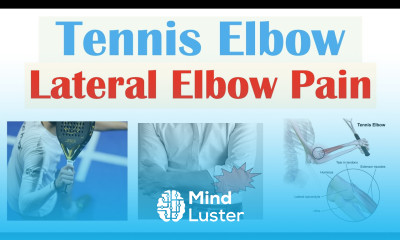 Tennis Elbow Lateral Epicondylitis Causes Pathophysiology Symptoms Diagnosis Treatment