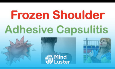 Frozen Shoulder Adhesive Capsulitis Causes Symptoms Stages Diagnosis Treatment