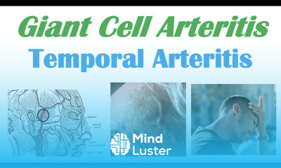 Giant Cell Arteritis Temporal Arteritis Causes Pathophysiology Symptoms Diagnosis Treatment