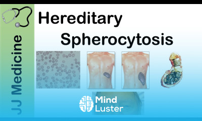 Hereditary Spherocytosis Pathophysiology Symptoms Diagnosis and Treatment
