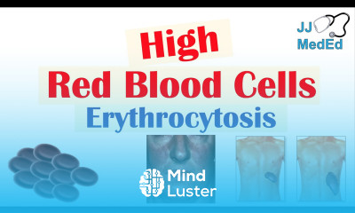 High Red Blood Cells Erythrocytosis Causes Signs and Symptoms and Treatment