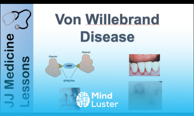 Von Willebrand Disease Pathophysiology Types Symptoms and Treatment