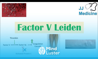 Factor V Leiden Causes Pathophysiology Symptoms Diagnosis Treatment