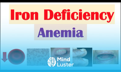 Iron Deficiency Anemia Overview Causes Pathophysiology Signs Symptoms Diagnosis Treatment