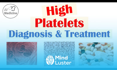 What is Thrombocytosis Diagnosis Treatment of High Platelets Rapid Review