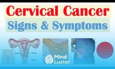 Cervical Cancer Signs Symptoms Why They Occur