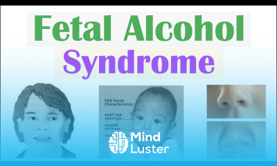 Fetal Alcohol Syndrome FAS Risk Factors Pathophysiology Signs Symptoms Diagnosis Treatment