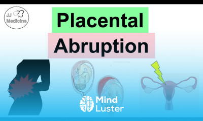 Placental Abruption Abruptio Placentae Risk Factors Symptoms Complications Diagnosis Treatment