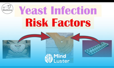Vaginal Candidiasis “Yeast Infection” Risk Factors Ways to Reduce Risk