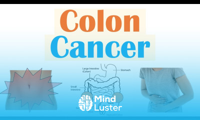 Colon Cancer CRC Risk Factors Pathogenesis Symptoms Diagnosis Staging Treatment
