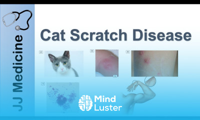 Cat Scratch Disease Causes Symptoms and Treatment