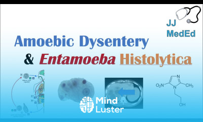 Amebiasis Amoebic Dysentery Entamoeba histolytica Pathogenesis Signs Symptoms Treatment