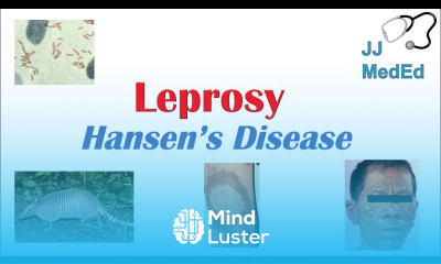 Leprosy Hansen s disease Who is at risk Signs and Symptoms Diagnosis and Treatment