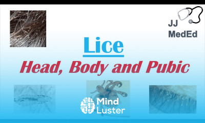 Lice Head Body and Pubic Lice Pediculosis Species Symptoms and Treatment