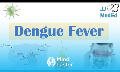 Dengue Fever Pathophysiology Symptoms Diagnosis Treatment