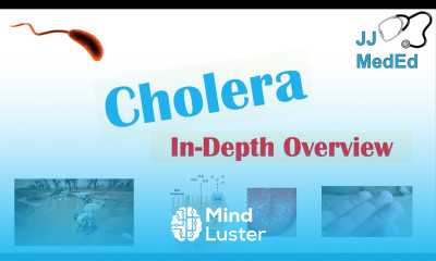 Cholera Vibrio Cholerae Pathophysiology Risk Factors Symptoms Diagnosis and Treatment