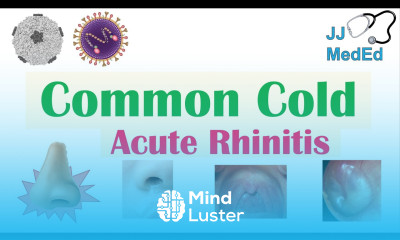 Common Cold Acute Rhinitis Causes ex Coronaviruses Risk Factors Transmission Symptoms