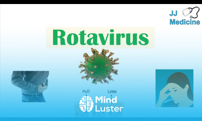 Rotavirus Risk Factors Pathophysiology Symptoms Diagnosis Treatment