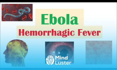 Overview of Ebola Hemorrhagic Fever Causes Pathophysiology Symptoms Diagnosis Treatment