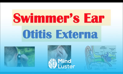 Swimmer s Ear Otitis Externa Risk Factors Causes Signs Symptoms Diagnosis Treatment