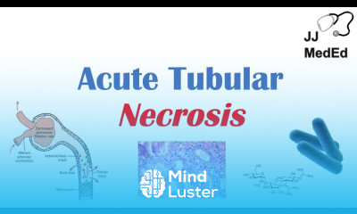 Acute Tubular Necrosis ATN Symptoms Causes and Treatments