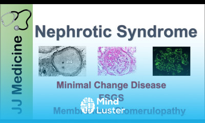 Nephrotic Syndrome Clinical Presentation Causes and Treatment