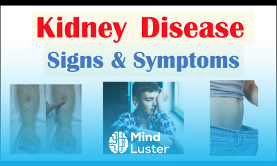 Kidney Renal Disease Signs Symptoms ex Peripheral Edema Fatigue Itchiness