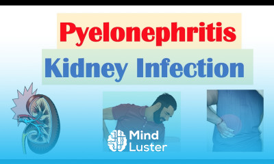 Pyelonephritis Kidney Infection Causes Pathophysiology Signs Symptoms Diagnosis Treatment