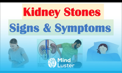 Kidney Stones Nephrolithiasis Signs Symptoms Why They Occur
