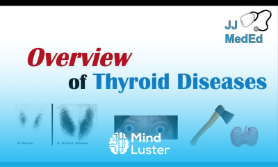 Overview of Thyroid Diseases Hashimoto s Graves Sick Euthyroid Syndrome Toxic adenoma etc