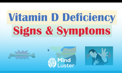 Vitamin D Deficiency Signs Symptoms ex Fatigue Diagnosis Treatment