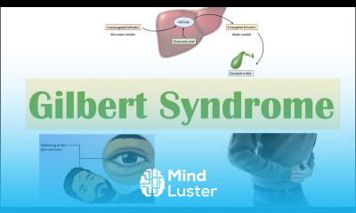 Gilbert Syndrome Causes Genetics Pathogenesis Signs Symptoms Diagnosis Treatment