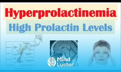 Hyperprolactinemia High Prolactin Levels Causes Signs Symptoms Diagnosis Treatment