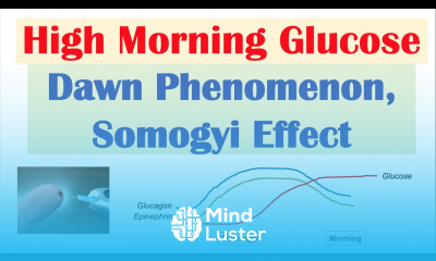High Early Morning Glucose Dawn Phenomenon Somogyi Effect