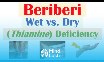 Beriberi Thiamine Deficiency Wet vs Dry Beriberi Pathophysiology Symptoms Diagnosis Treatment