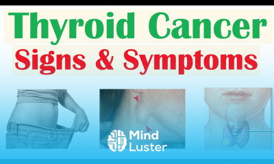 Thyroid Cancer Signs Symptoms Why They Occur