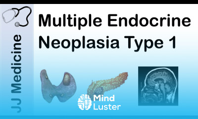 Multiple Endocrine Neoplasia Type 1 MEN 1 Signs and Symptoms Diagnosis and Treatment