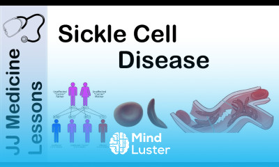 Sickle Cell Disease Pathophysiology Symptoms and Treatment