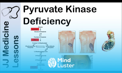 Pyruvate Kinase Deficiency Symptoms Pathophysiology and Treatment