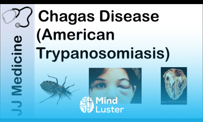 Chagas Disease American Trypanosomiasis Causes Symptoms and Treatment